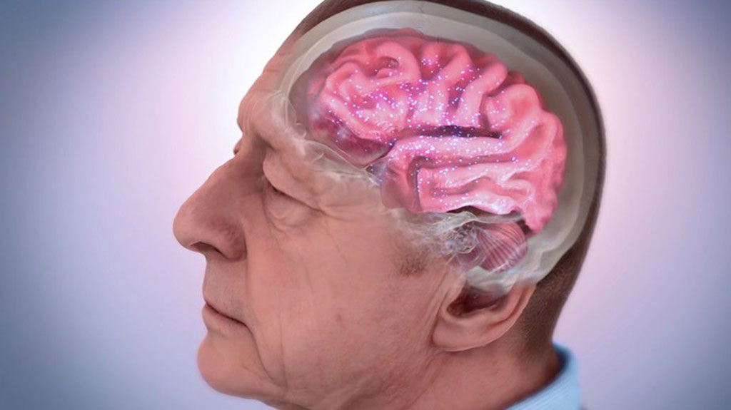 Imagen: Los investigadores están explorando el uso deaprendizaje automático para un sistema mínimamente invasivo para detectar la enfermedad de Alzheimer (Fotografía cortesía de NIH)
