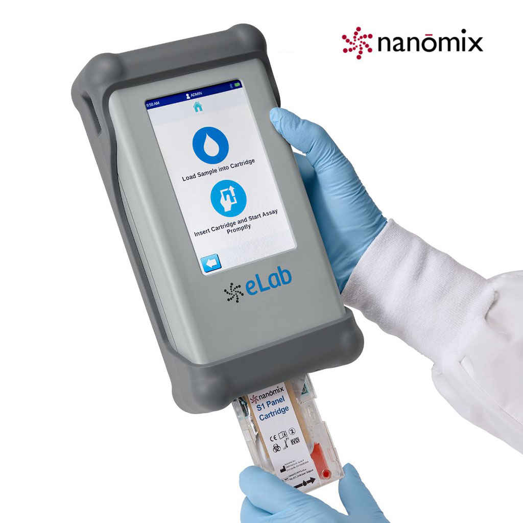 Imagen: Nanōmix eLab es un sistema de diagnóstico químico y de inmunoensayo portátil y móvil  (Fotografía cortesía de Nanomix)