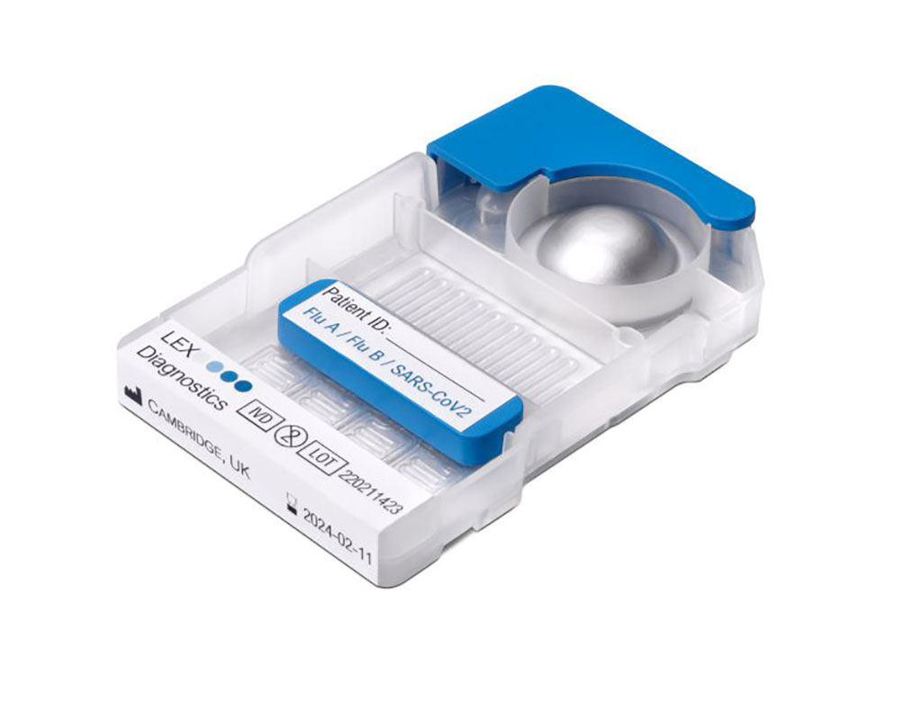 Imagen: El sistema LEX tiene como objetivo brindar información de PCR verdadera a los médicos en el momento en que son más valiosos (Fotografía cortesía de LEX)