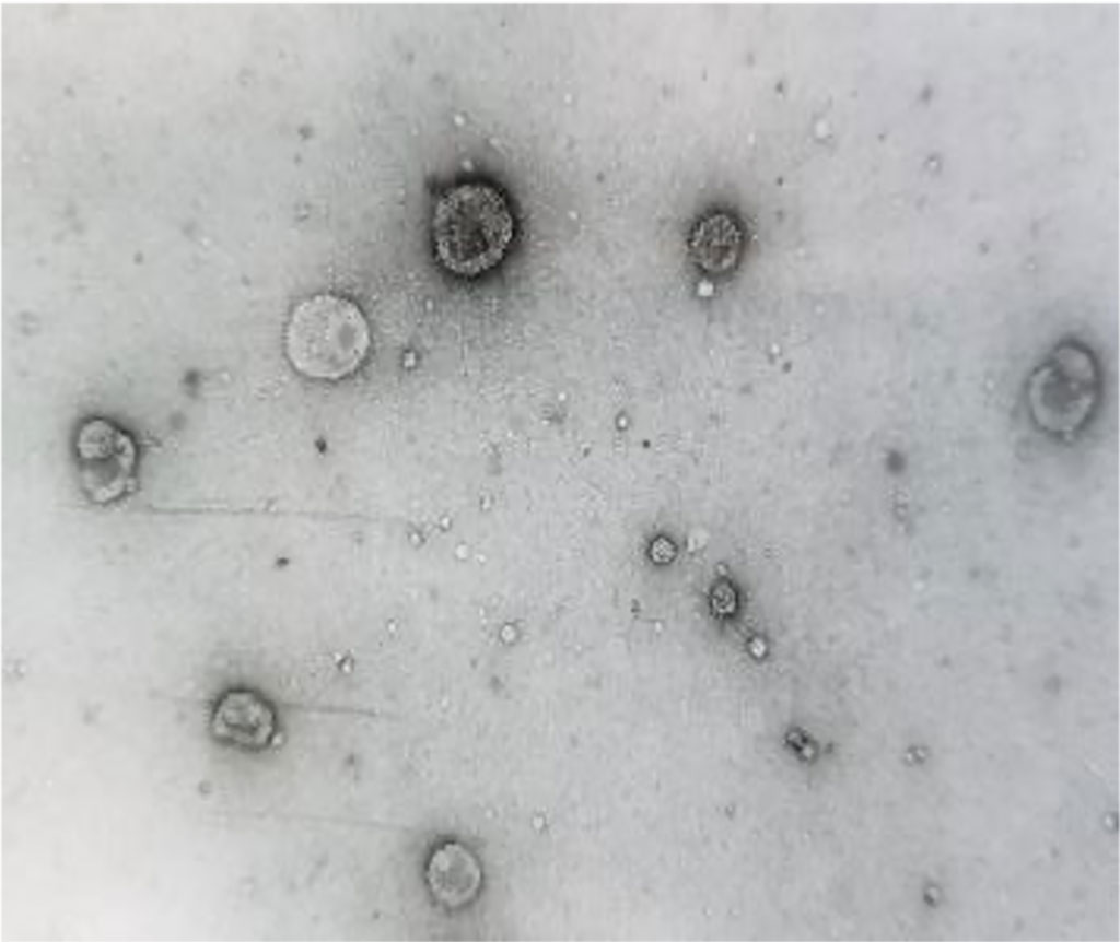 Imagen: Vesículas extracelulares de orina (uEV) (Fotografía cortesía de la Universidad de Tokio)