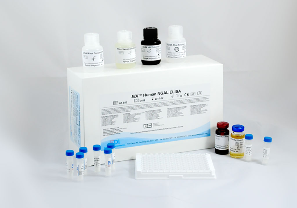 Imagen: Un kit ELISA sándwich de lipocalina asociada a gelatinasa de  (NGAL) /lipocalina-2 humana(Fotografía cortesía de Epitope Diagnostics Inc.)