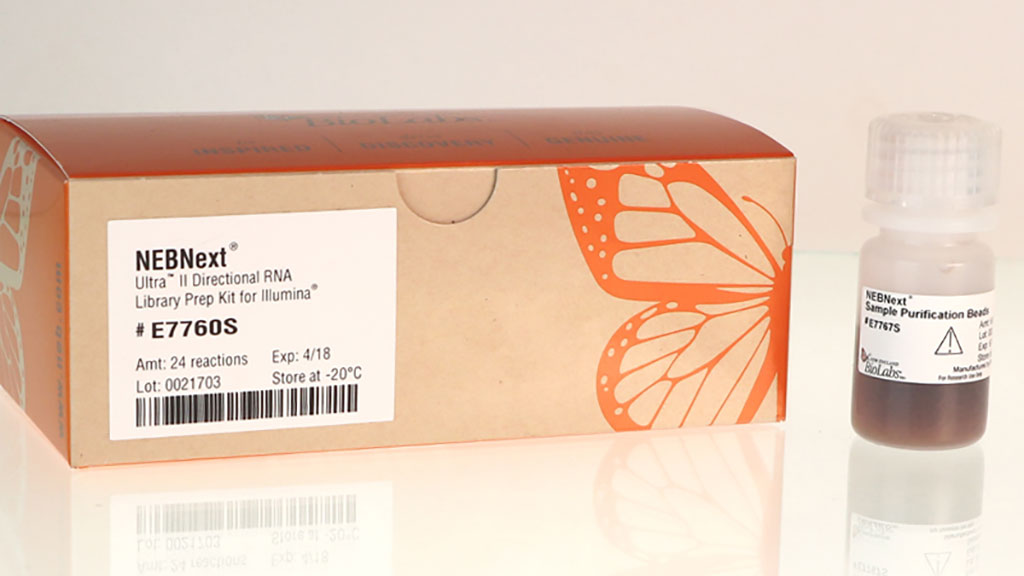 Imagen: Kit NEBNext Ultra II para la preparación de bibliotecas de ARN direccional (Fotografía cortesía de New England Biolabs)