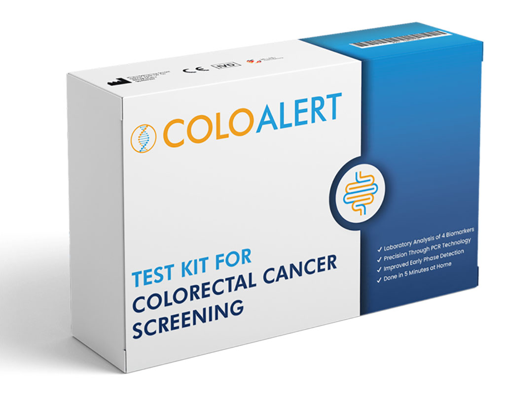 Imagen: ColoAlert es la única prueba basada en ADN CE-IVD disponible en Europa (Fotografía cortesía de Mainz Biomed)
