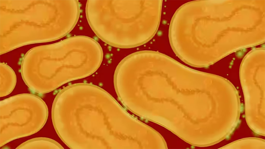 Imagen: El kit TaqPath Monkeypox/Orthopox Virus DNA  de Applied Biosystems ha recibido la EUA de la FDA (Fotografía cortesía de Thermo Fisher)
