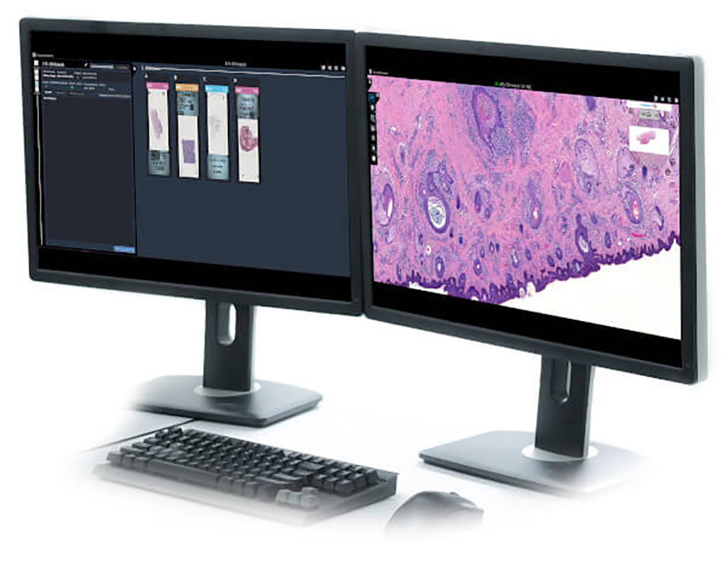 Imagen: Dynamyx es la primera y única autorización de la FDA para un software de patología digital con múltiples escáneres (Fotografía cortesía de Inspirata)
