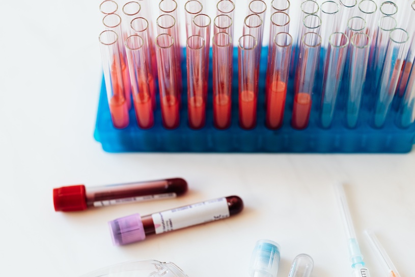 La primera prueba de sangre pancancerosa podría predecir la eficacia y la toxicidad de los inhibidores del punto de control inmunitarios (Fotografía cortesía de Pexels)