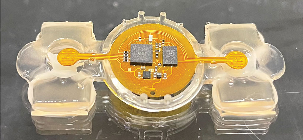 Imagen: Los eBiobots son las primeras máquinas biohibridas inalámbricas, que combinan tejido biológico, microelectrónica y polímeros blandos impresos en 3D (Fotografía cortesía de Yongdeok Kim)