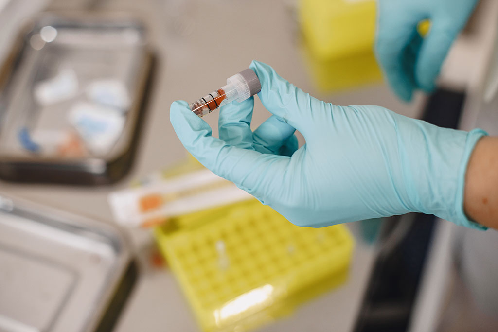 Imagen: El nuevo análisis de sangre detecta el cáncer de próstata con mayor precisión que los métodos actuales (Fotografía cortesía de Pexels)