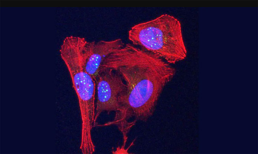 Imagen: Proteína telomérica VR recién descubierta (esferas verdes) (Fotografía cortesía de la Facultad de Medicina de la UNC)