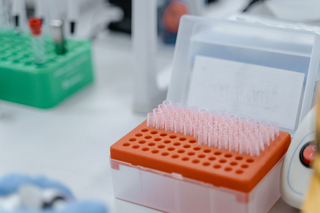 Imagen: El biosensor podría ayudar a optimizar el tratamiento del cáncer, identificar factores de daño del ADN y dilucidar los mecanismos de reparación (Fotografía cortesía de Pexels)