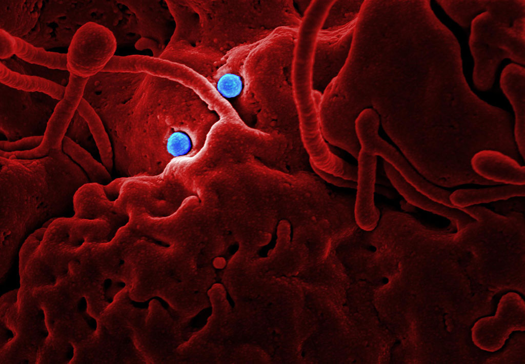 Imagen: Los biomarcadores han mostrado ser prometedores para identificar el riesgo temprano de cáncer de páncreas (Fotografía cortesía de Pexels)