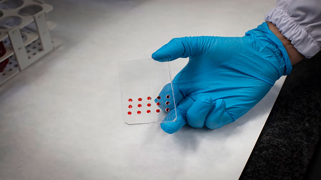 Imagen: Nuevo dispositivo microfluídico basado en la física predice la respuesta a la terapia del cáncer (Fotografía cortesía de la Universidad de Barcelona)