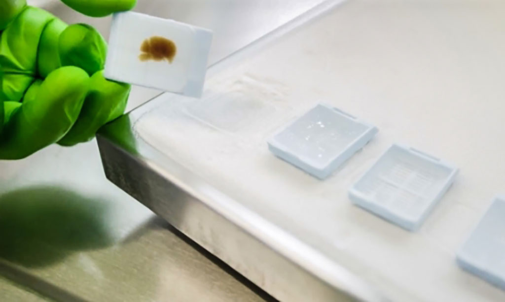 Imagen: La prueba Mamma Typerr está optimizada para su uso en todos los laboratorios de patología molecular (Fotografía cortesía de Cerca)