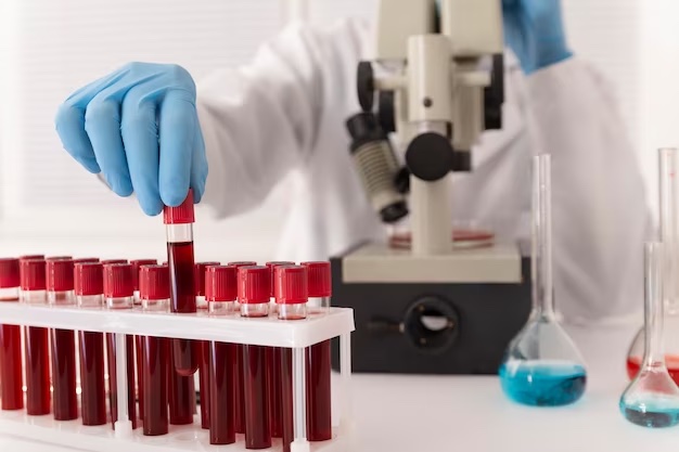 Un conjunto de análisis de sangre utilizados en combinación con pruebas de memoria puede diagnosticar correctamente la enfermedad de Alzheimer (Fotografía cortesía de Freepik)