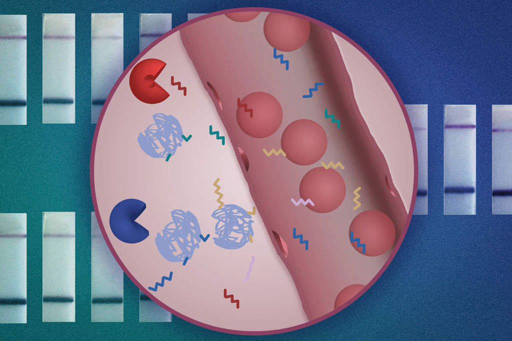 Imagen: El nuevo sensor de nanopartículas podría permitir el diagnóstico temprano de cáncer con una simple prueba de orina (Fotografía cortesía del MIT)