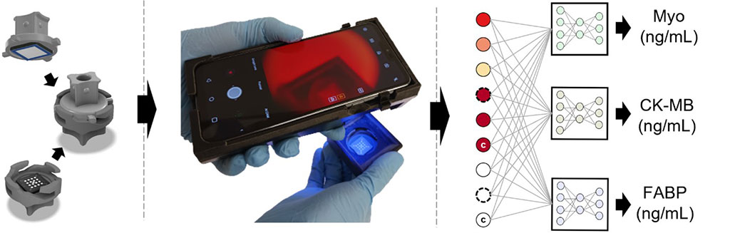 Imagen: Sensor POC habilitado para el aprendizaje profundo utilizando un ensayo de flujo vertical multiplexado de fluorescencia basado en papel (Fotografía cortesía de UCLA)