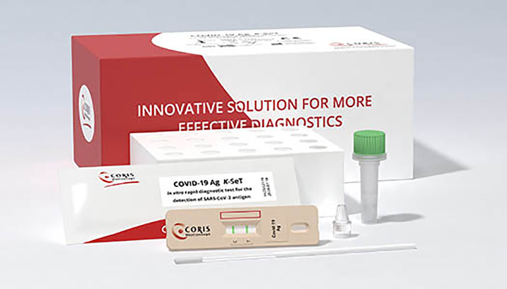 Imagen: La adquisición de Coris proporciona a Avacta una cartera amplia de productos de prueba rápida de uso profesional (Fotografía cortesía de Coris Bioconcept)