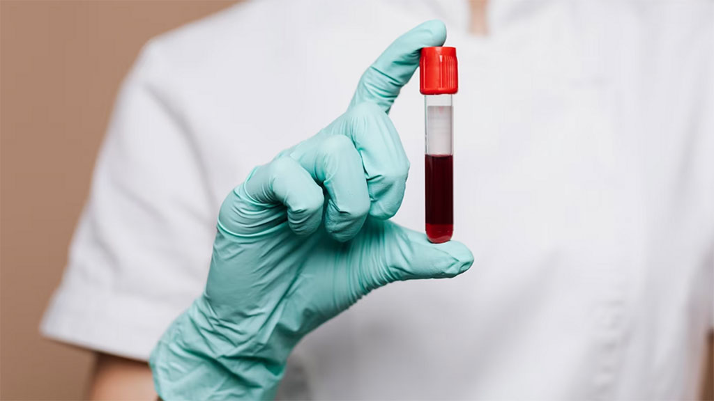 Imagen: Los científicos han identificado tumores cerebrales usando muestras de sangre (Fotografía cortesía de Freepik)