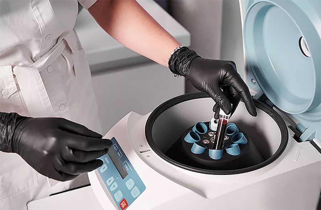 Imagen: La prueba de sangre de detección temprana para varios tipos de cáncer utiliza NGS e IA (Fotografía cortesía de Freepik)