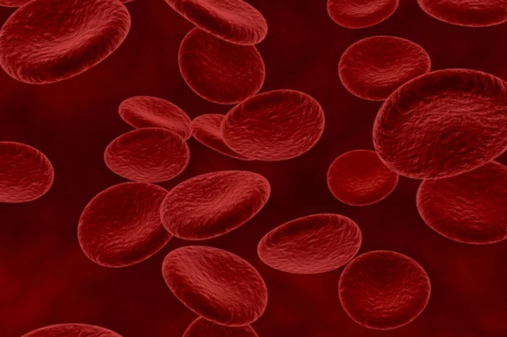 Imagen: La enfermedad de las células falciformes es un trastorno sanguíneo caracterizado por glóbulos rojos rígidos y en forma de hoz (Fotografía cortesía de Freepik)