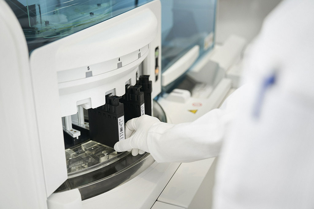Imagen: La relación Elecsys tTau/Abeta42 aprobada por la FDA respalda el diagnóstico oportuno de la enfermedad de Alzheimer y la toma de decisiones sobre el tratamiento (Fotografía cortesía de Roche)