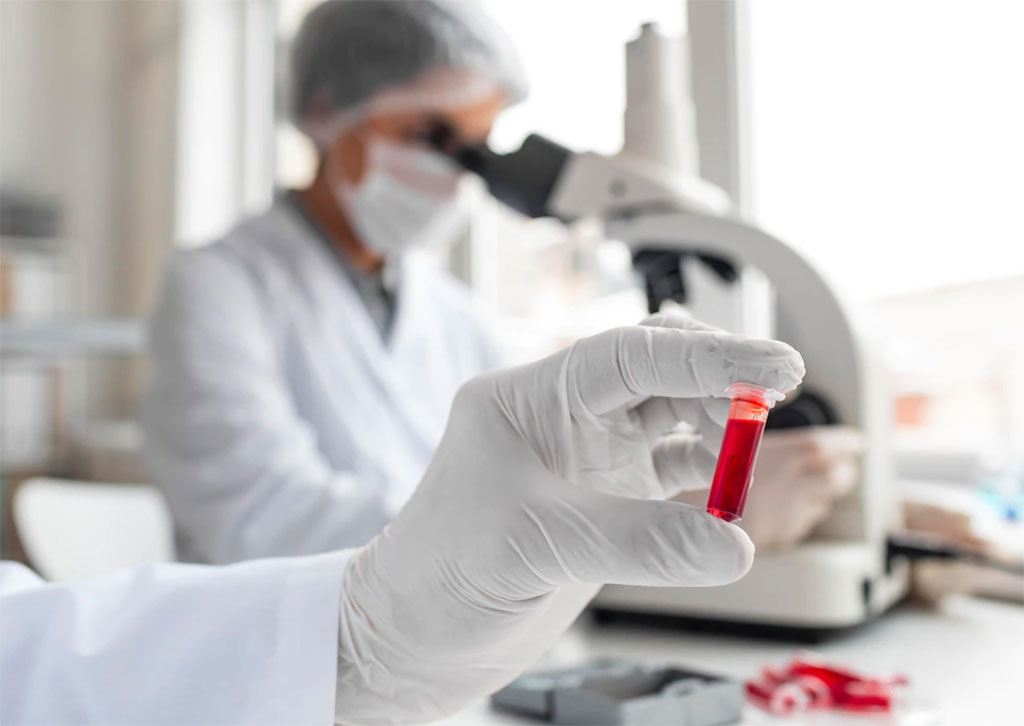 Imagen: Análisis de sangre curado más un modelo de predicción pueden reducir la muerte por cáncer de pulmón al informar la necesidad de una TC de detección (Fotografía cortesía de Freepik)