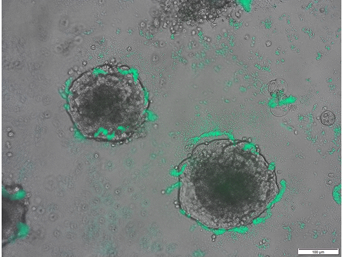Imagen: Como se ve en una placa, las bacterias Acinetobacter baylyi (verdes) envuelven grupos de células de cáncer colorrectal (Fotografía cortesía de UC San Diego)