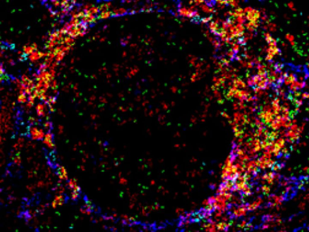 Imagen: Foto de glomérulos de riñón, codificado por color para diferentes tipos de células, tomada por citometría de masa con imágenes (Fotografía cortesía de la Universidad de Houston)
