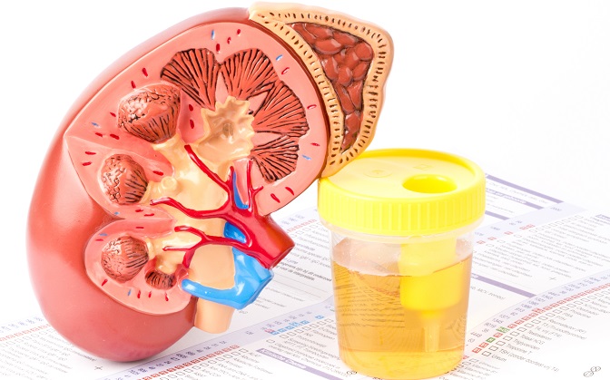 Imagen: El metabolito en la orina puede predecir insuficiencia renal diabética 5 a 10 años antes (Fotografía cortesía de Tom Schomakers, Shutterstock.com)