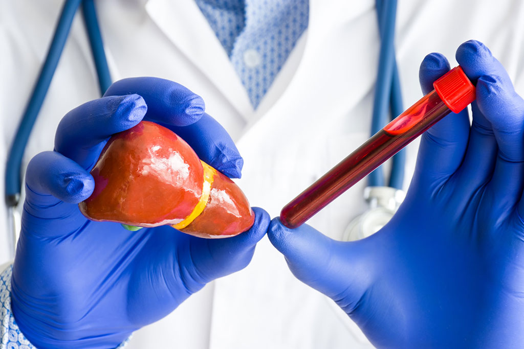 Image: Non-invasive biomarker testing could be an alternative to painful liver biopsy (Photo courtesy 123RF)