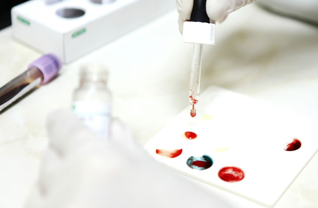 Imagen: La prueba de diagnóstico basada en glóbulos detecta la encefalomielitis mialgica/síndrome de fatiga crónica (Fotografía cortesía de 123RF)
