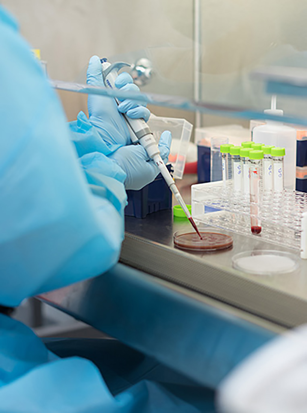 Imagen: El proceso Blood2Bac permite la cobertura de secuenciación del genoma completo de alta profundidad de patógenos bacterianos directamente de muestras de sangre clínica (Fotografía cortesía de Day Zero Diagnostics)