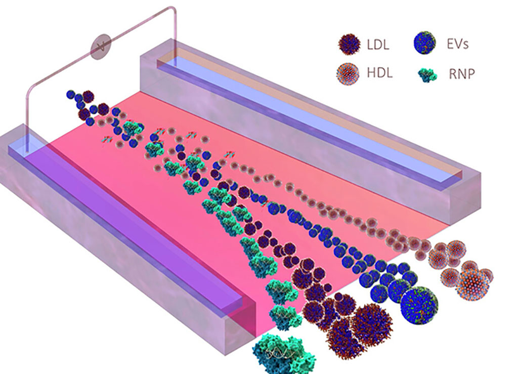 Imagen: La nueva tecnología podría conducir a diagnósticos de cáncer rápidos y mínimamente invasivos (Fotografía cortesía de la American Chemical Society)