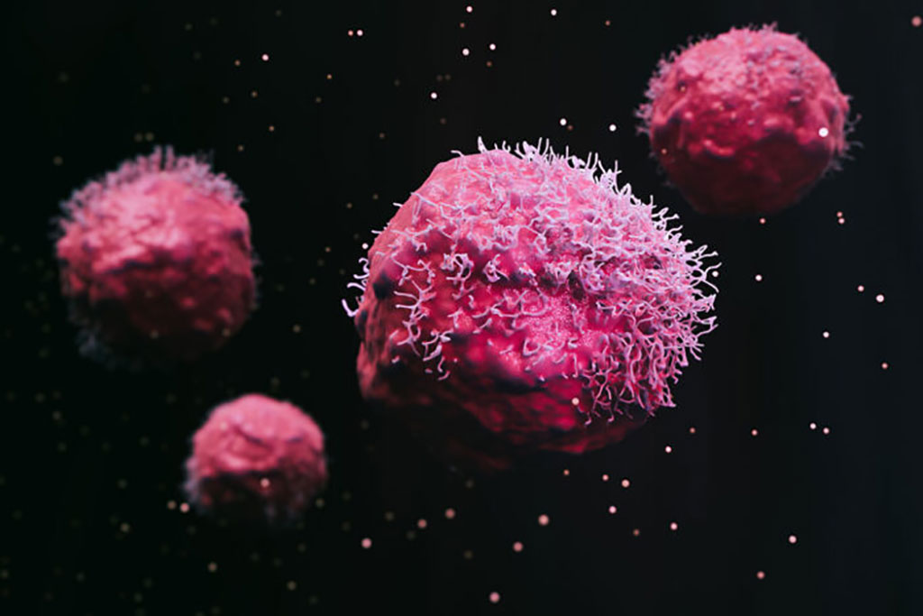 Imagen: Una prueba novedosa puede detectar un marcador molecular único en pacientes con leucemia mieloide aguda (Fotografía cortesía de WUSTL)