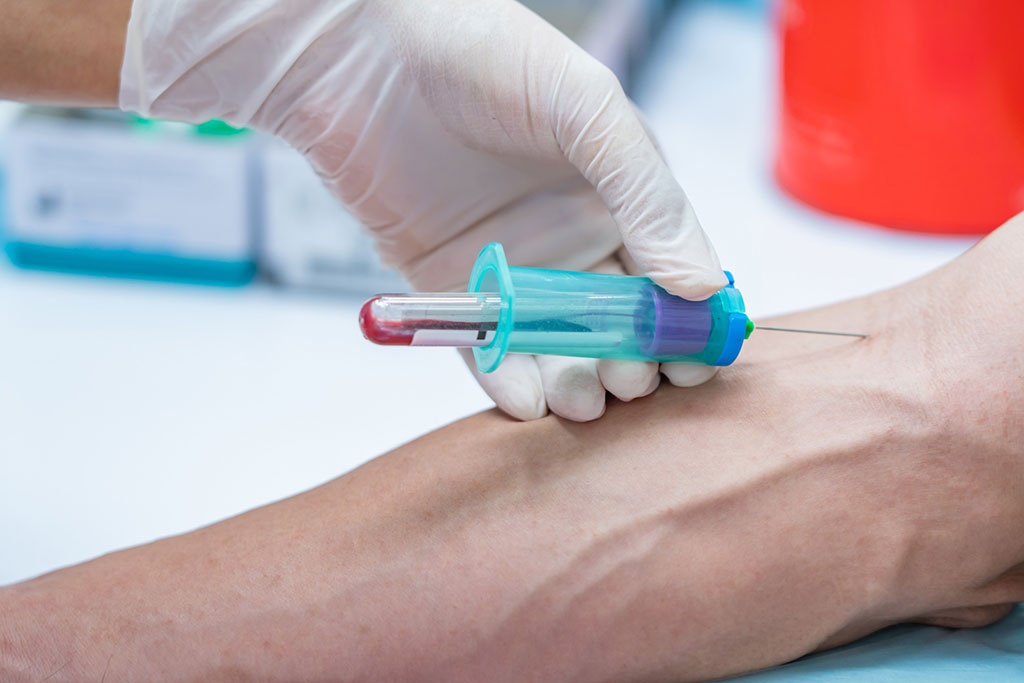 Imagen: Tener resultados directamente de sangre completa dentro de las seis horas puede informar mejor las decisiones de tratamiento de antibióticos para la sepsis (Fotografía cortesía de 123RF)