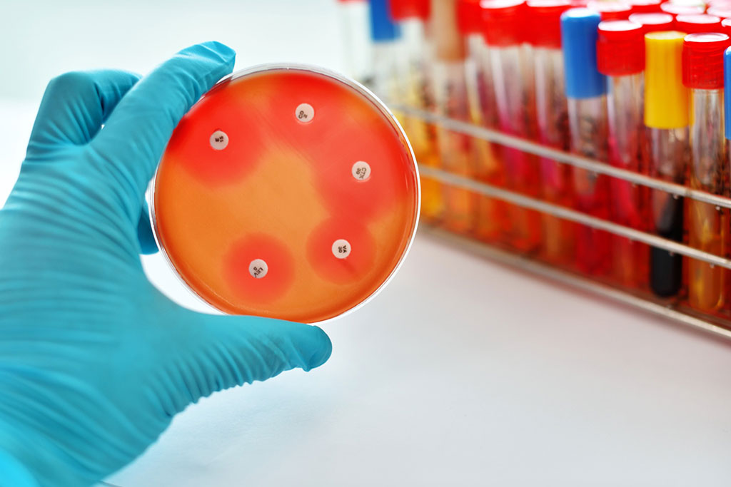 Imagen: Los métodos de prueba actuales para la susceptibilidad a los antibióticos se basan en el cultivo de colonias bacterianas en presencia de antibióticos (Fotografía cortesía de 123RF)