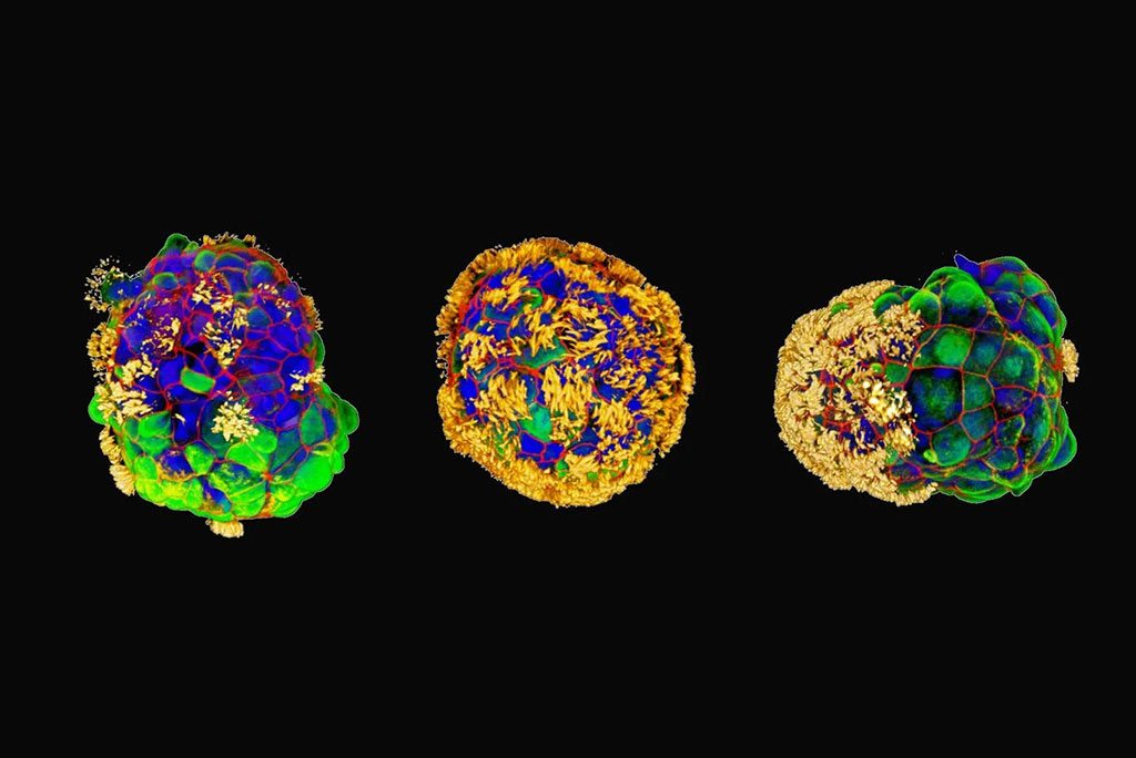 Imagen: Tres ejemplos de Antrobots con cilios en forma de cabello en amarillo (Fotografía cortesía de Gizem Gumuskaya)