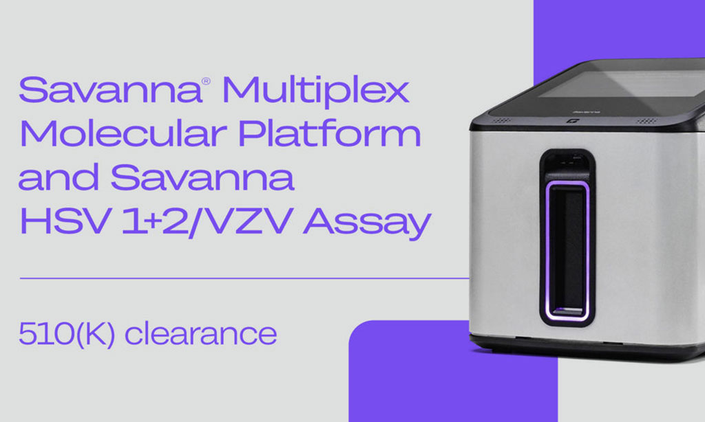 Imagen: La plataforma molecular multiplex Savanna y la prueba de PCR Savanna HSV 1+2/VZV han recibido la autorización de la FDA 510 (k) (Fotografía cortesía de QuidelOrtho)