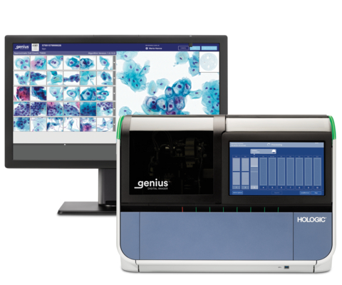 Imagen: Sistema de citología digital aprobado por la FDA, Sistema de diagnóstico digital Genius (Fotografía cortesía de Hologic)
