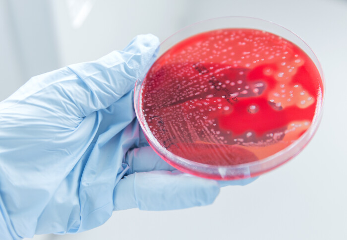 Imagen: Streptococcus pyogenes en una placa de Petri (Fotografía cortesía del Colegio Imperial de Londres)