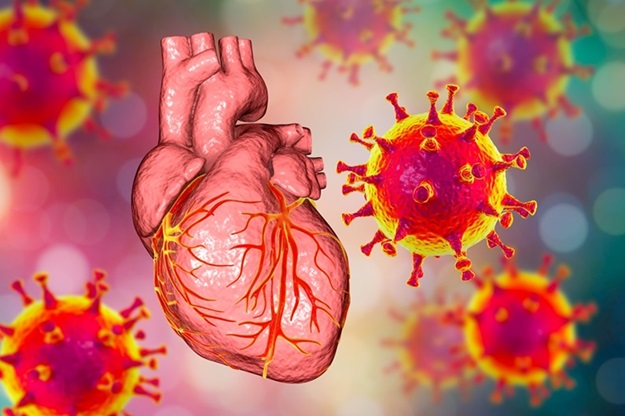Imagen: La investigación ha mostrado que las infecciones virales plantean riesgos cardíacos tempranos (Fotografía cortesía de Kateryna Kon/Shutterstock)