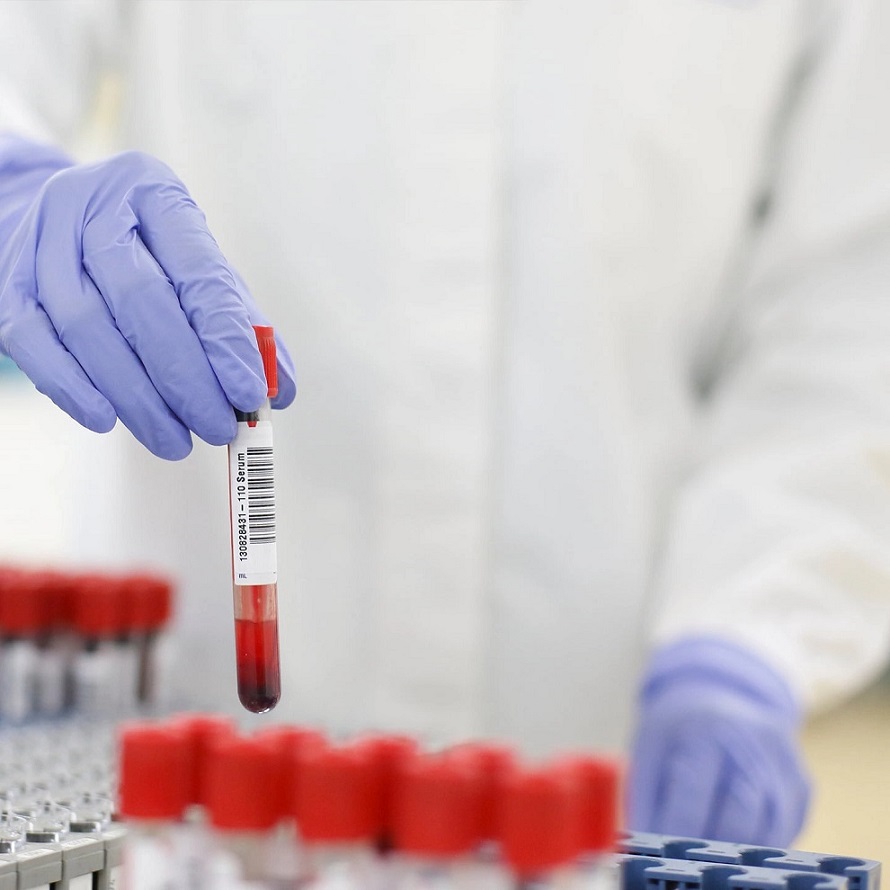 Imagen: La prueba cobas Malaria es la primera prueba molecular aprobada por la FDA para detectar malaria en donantes de sangre estadounidenses (Fotografía cortesía de Roche)