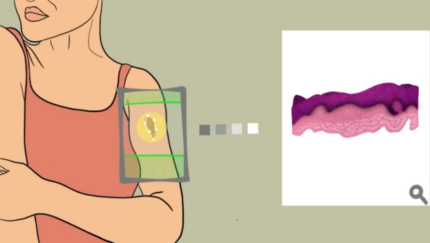 Imagen: La 'biopsia virtual' permite a los médicos analizar la piel de forma no invasiva (Fotografía cortesía de Stanford Medicine)
