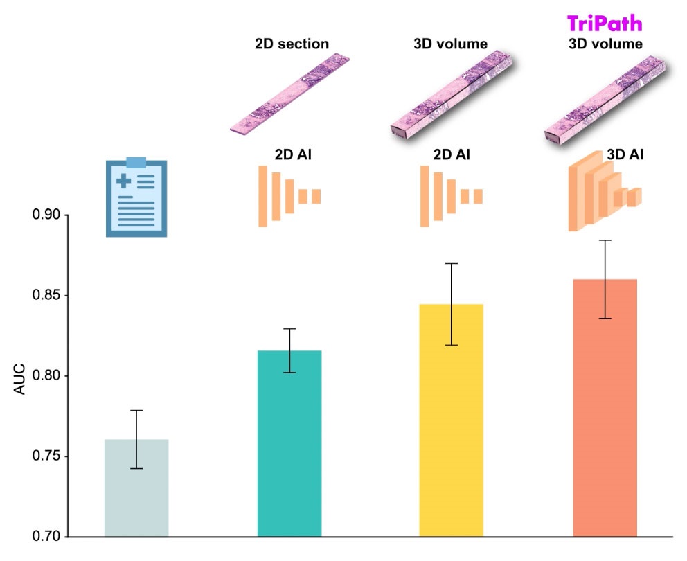 Imagen: Tripath (extremo derecho) supera a la línea de base clínica actual (extremo izquierdo) y líneas de base de aprendizaje profundo 2D (medio) en la predicción del riesgo de recurrencia del cáncer (foto cortesía del Mass General Brigham)