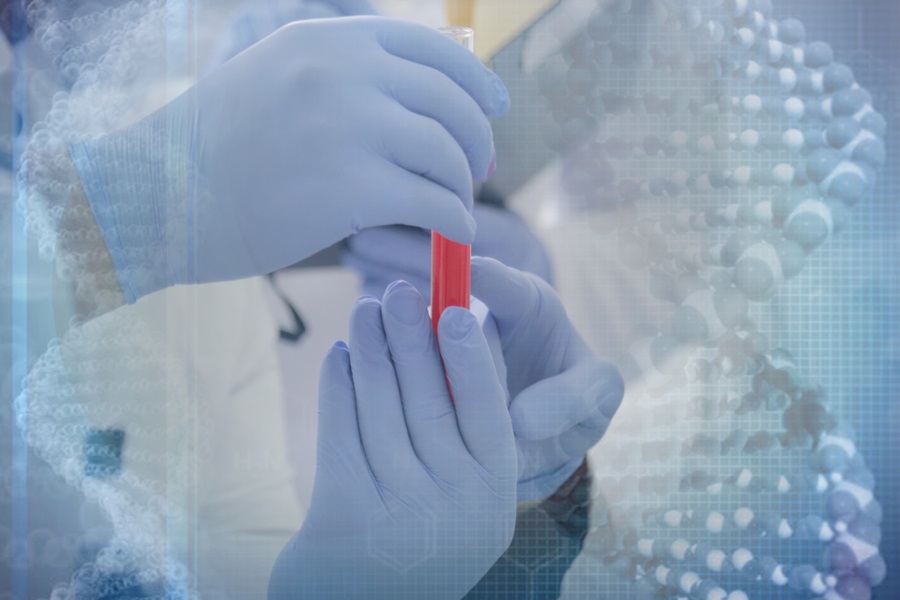 Imagen: La prueba novedosa utiliza un procedimiento de diagnóstico existente como base para dirigirse al virus Epstein Barr (Foto cortesía de 123RF)