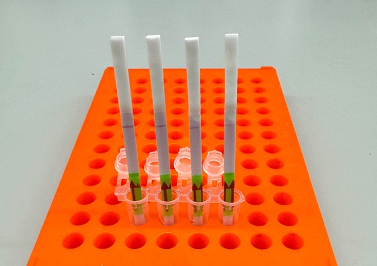 Imagen: La prueba de diagnóstico rápido SHINE utiliza tiras de papel y enzimas CRISPR para identificar secuencias específicas de ARN viral en muestras (foto cortesía de Jon Arizti-Sanz)