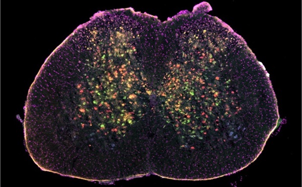 Imagen: Neuronas de la médula espinal (foto cortesía de la Universidad de St Andrews)
