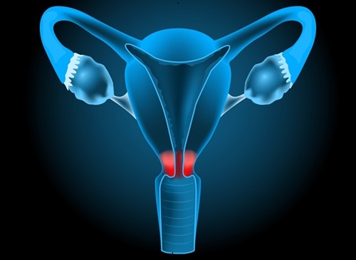 Imagen: El método permite a los investigadores identificar nuevos biomarcadores en muestras de moco cervical con alto poder diagnóstico (foto cortesía de Shutterstock)