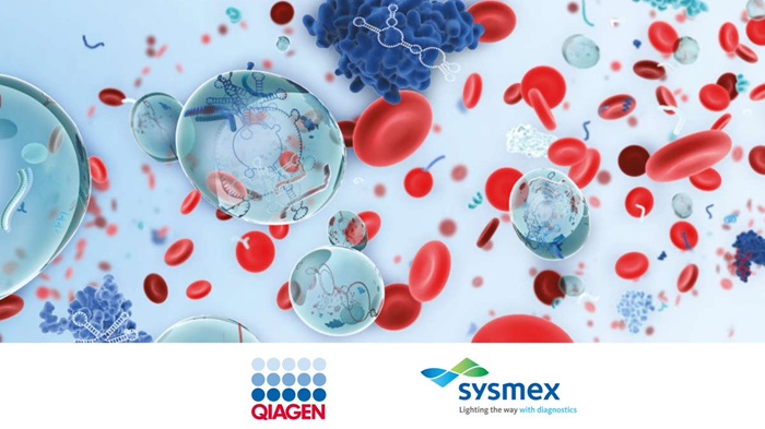 Imagen: Sysmex ha ampliado su acuerdo de alianza estratégica con QIAGEN en el campo de las pruebas genéticas (foto cortesía de Qiagen)