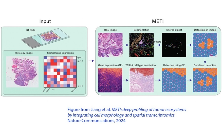 Imagen: La innovadora herramienta de software analiza células cancerosas en portaobjetos de biopsia (foto cortesía de Nature Communicationsa)